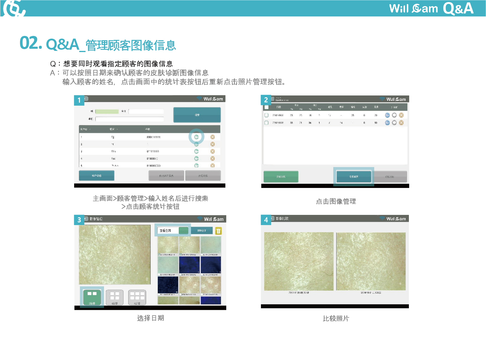 皮肤/头皮 诊断仪 (图7)